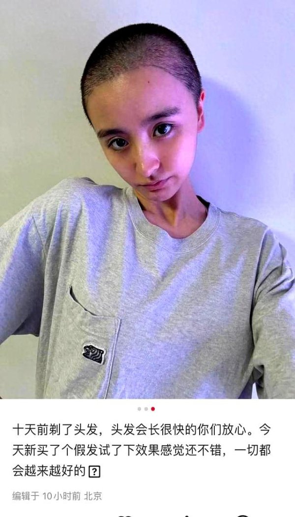 26岁女星文告退出文娱圈后剃秃子发，家东谈主分解她并无疾病